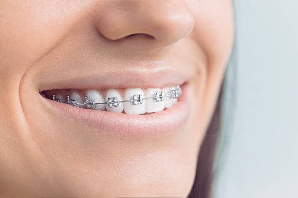 Best Traditional Braces  in Pierre, SD